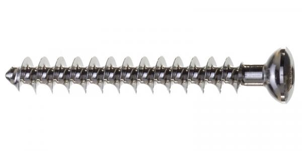 Cancellous screw: diameter 4.0 x 55